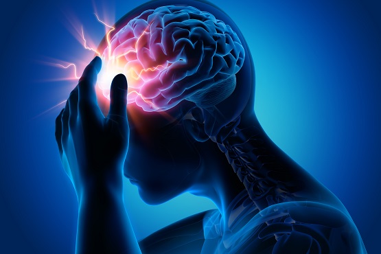 CPD Epilepsy Course