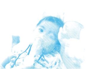 Update on the prevention and management of RSV in Ireland