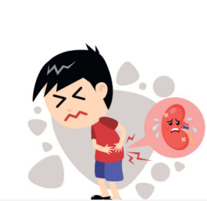Childhood Nephrotic Syndrome